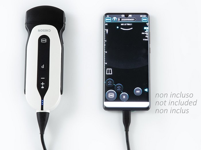 Doppler palmare CHISON SonoEye P5 SONDA CONVEX